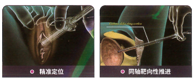 BETWAY(ķ)ٷվ-West Ham United